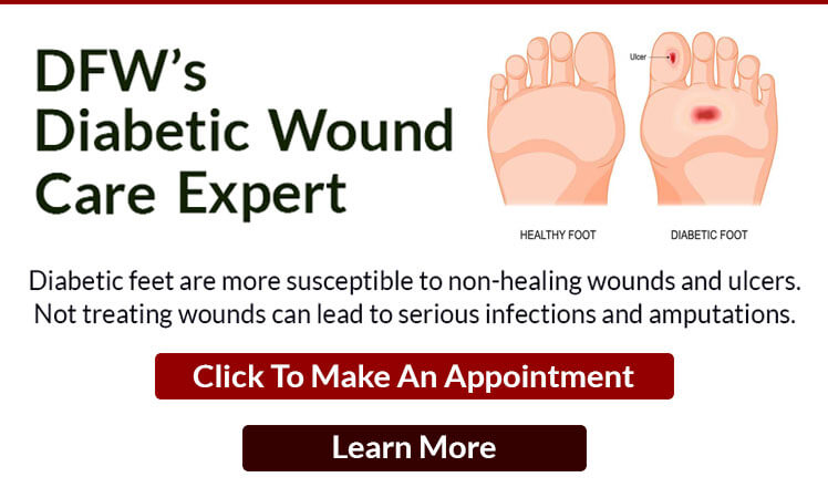 Diabetic Wound Care Expert in the Collin County, TX: Plano (Frisco, Allen, Murphy, Lucas) and Dallas County, TX: Garland, Carrollton, Richardson, Farmers Branch, Sachse, Addison areas