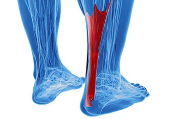 achilles tendon treatment in the Collin County, TX: Plano (Frisco, Allen, Murphy, Lucas) and Dallas County, TX: Garland, Carrollton, Richardson, Farmers Branch, Sachse, Addison areas