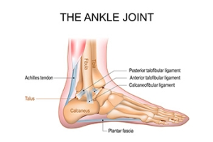 Types of Treatment for Ankle Instability