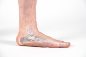 Exercises to Strengthen Flat Feet