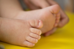 Helping Children with Ingrown Toenails